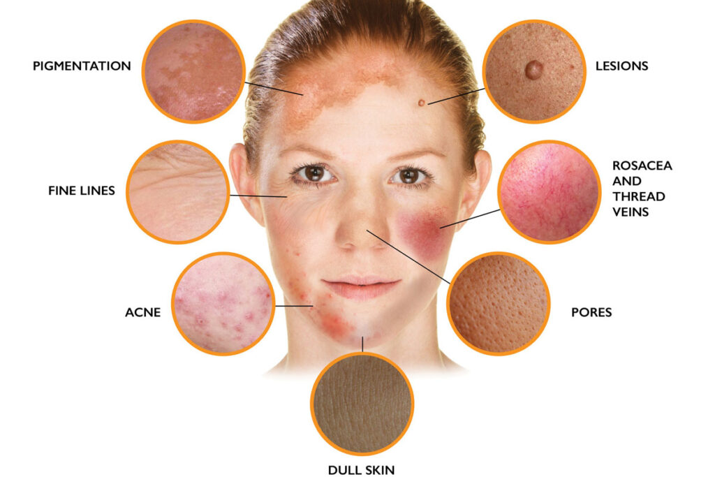 Key Diagnostic Differences Between Ringworm and Lookalikes