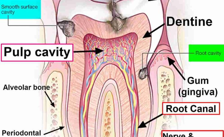 What Does a Cavity Look Like? Guide to Spotting Tooth Decay