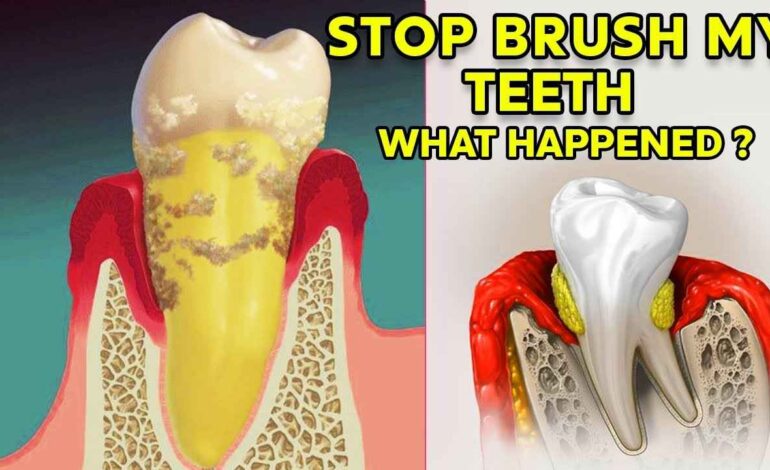 How Long Until a Tooth Infection Kills You? Risks and Treatment