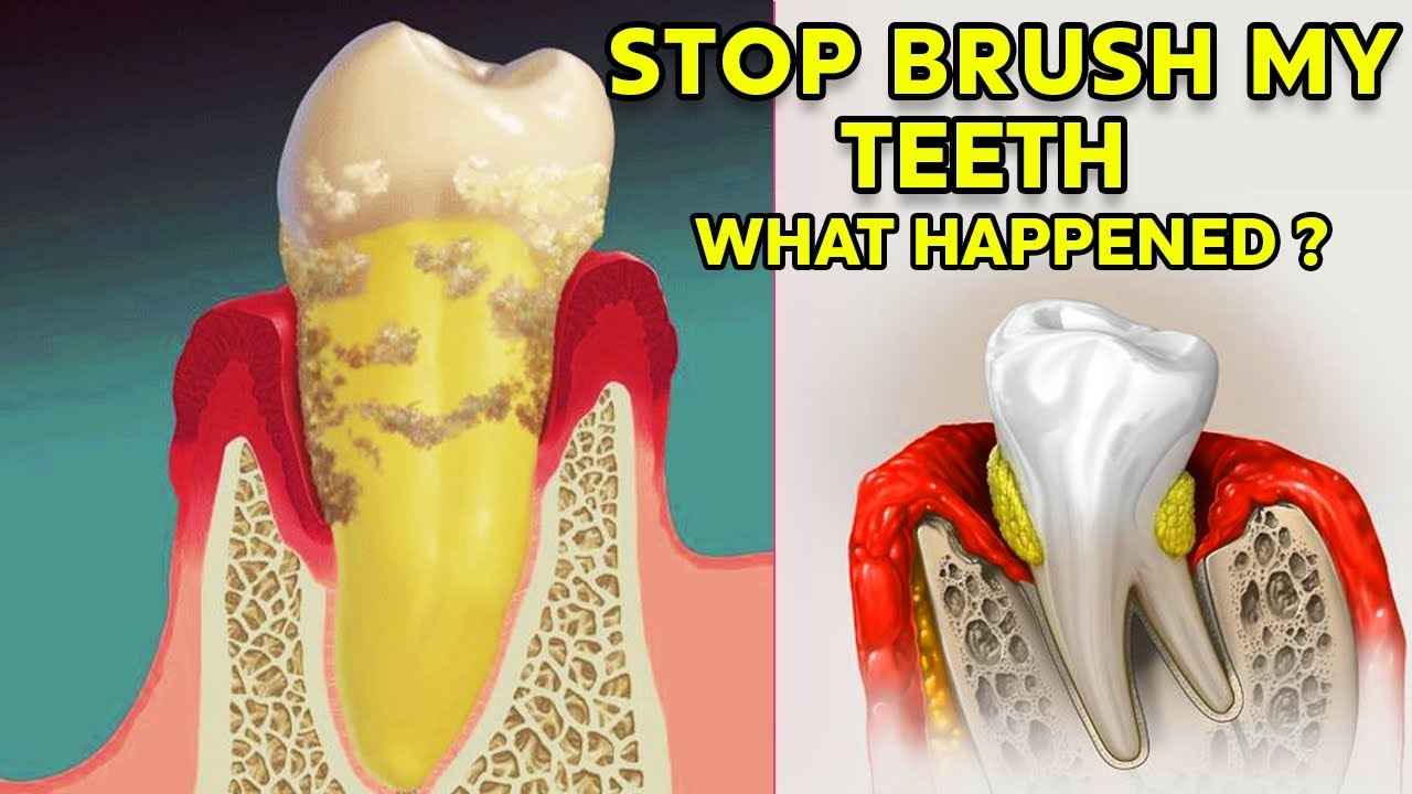 How Long Until a Tooth Infection Kills You? Risks and Treatment