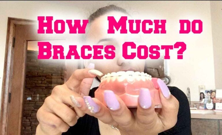 How Much Do Braces Cost in the USA? A Complete 2026 Price Guide
