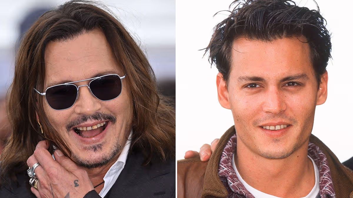 Johnny Depp Teeth Before and After: The Full Story